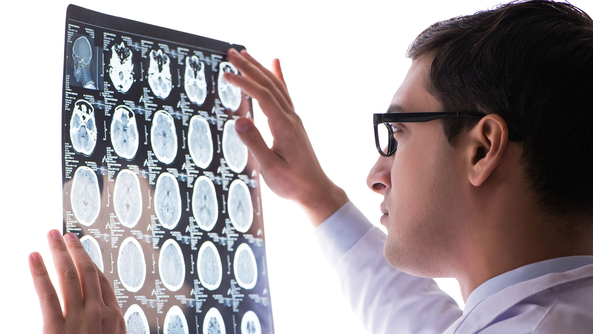 Male doctor looks at brain scan